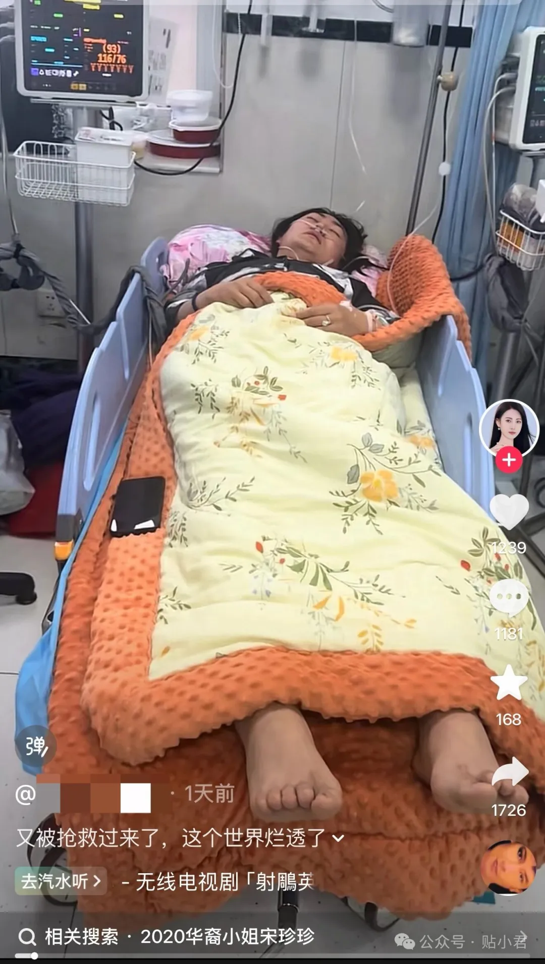史上最贵的吻，540亿没了