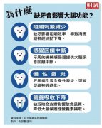广泛缺牙为何会增加失智风险？牙齿正常咬合 是守护大脑的关键